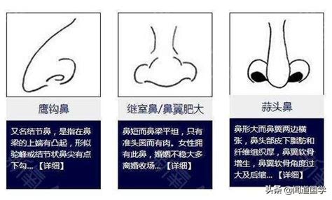 鼻子面相学|鼻相分析10款｜鼻樑有節及橫紋、豬膽鼻、鼻頭下垂代 